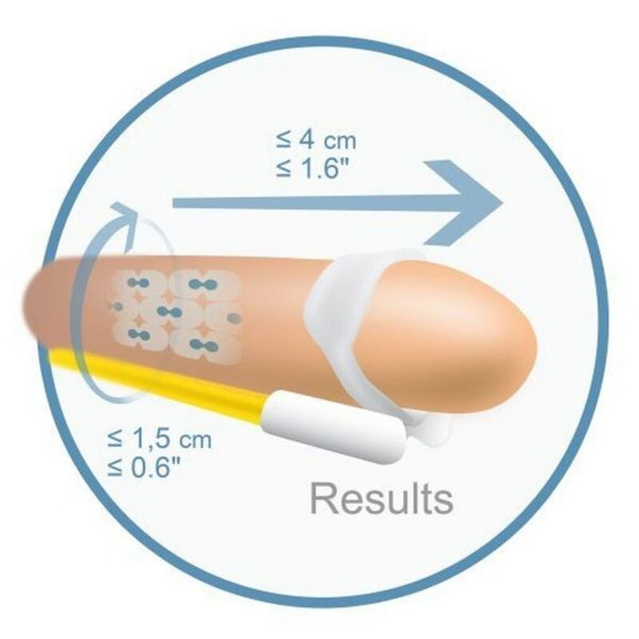 Penisförlängare Androextender Andromedical 8065